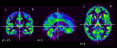 ../../_images/7cc637f82e1c75d5eb50af03ff6aacf83917010ca013e3d169f464f8d19b3451.png